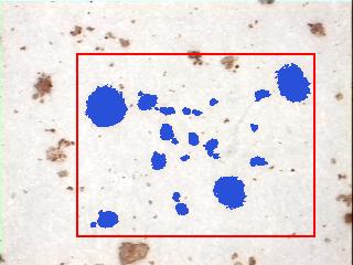 Blob Analysis Region of Interest (ROI)
