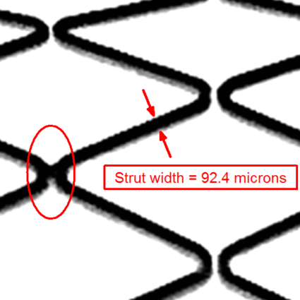 verifying stent integrity using VisionGauge software to measure strut widths