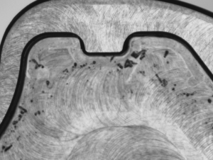 Orthopaedic Tibial Plate Inspection at 50X magnification with coax illumination on a VisionGauge Digital Optical Comparator