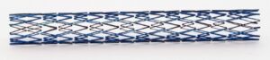 another example stent pattern