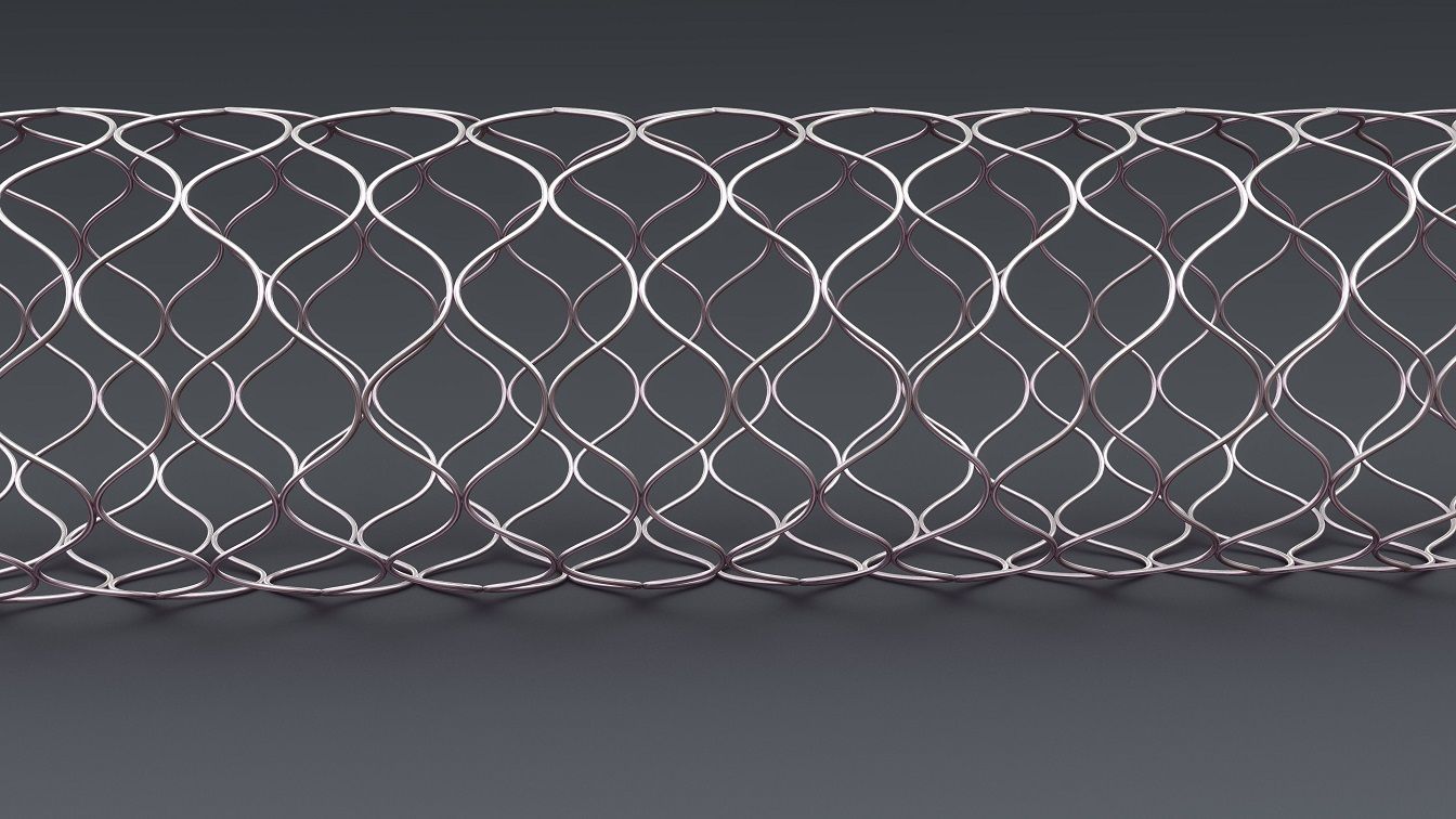 Stent inspection example pattern 4 Another supported stent example pattern