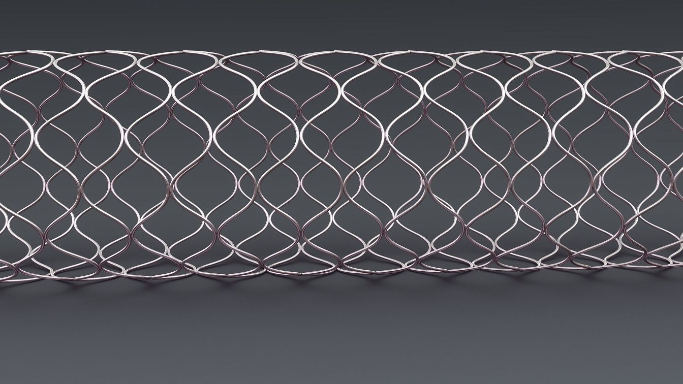 Another supported stent example pattern